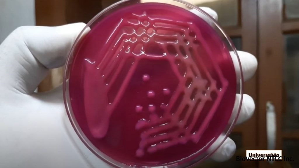 K pneumoniae:Introduction, Classification, Pathogenicity, Laboratory Diagnosis and Treatment