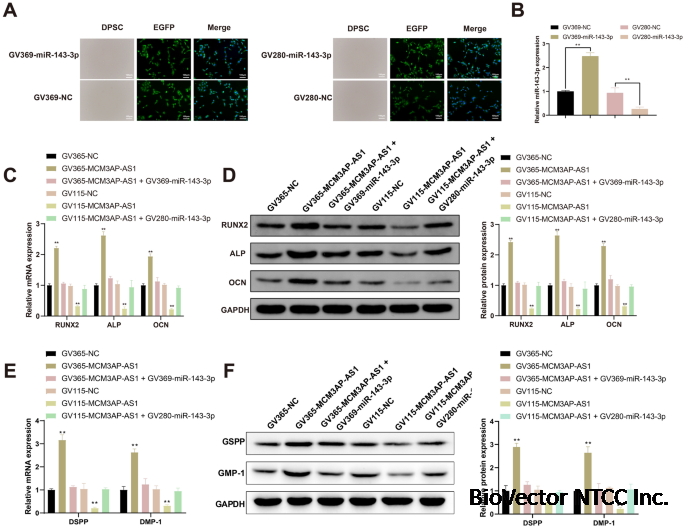Overexpression of long noncoding RNA MCM3AP-AS1 promotes osteogenic differentiation of dental pulp stem cells via miR-143-3p/IGFBP5 axis | Human Cell