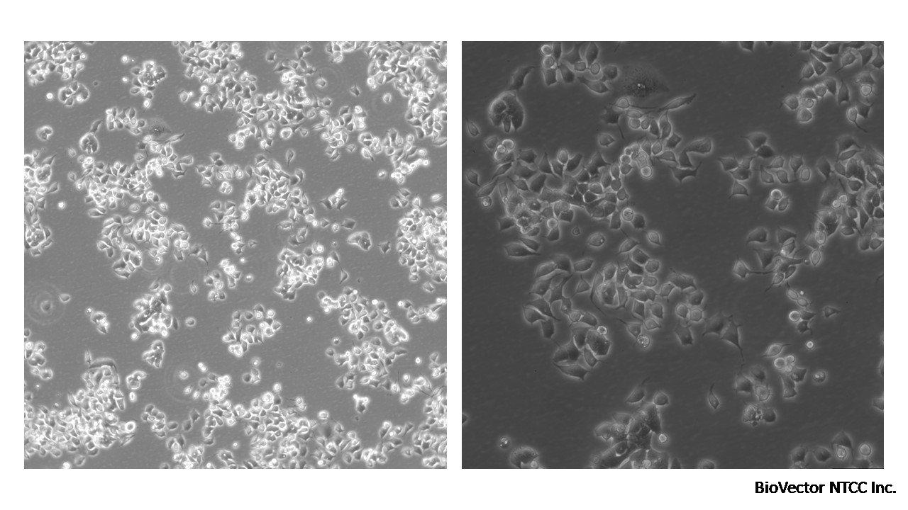 Neuro-2a Cell Line:Paving the Way in Neuroscience Research