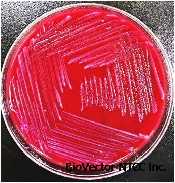 The first case of Odoribacter splanchnicus bacteremia isolated from a patient in China - ScienceDirect