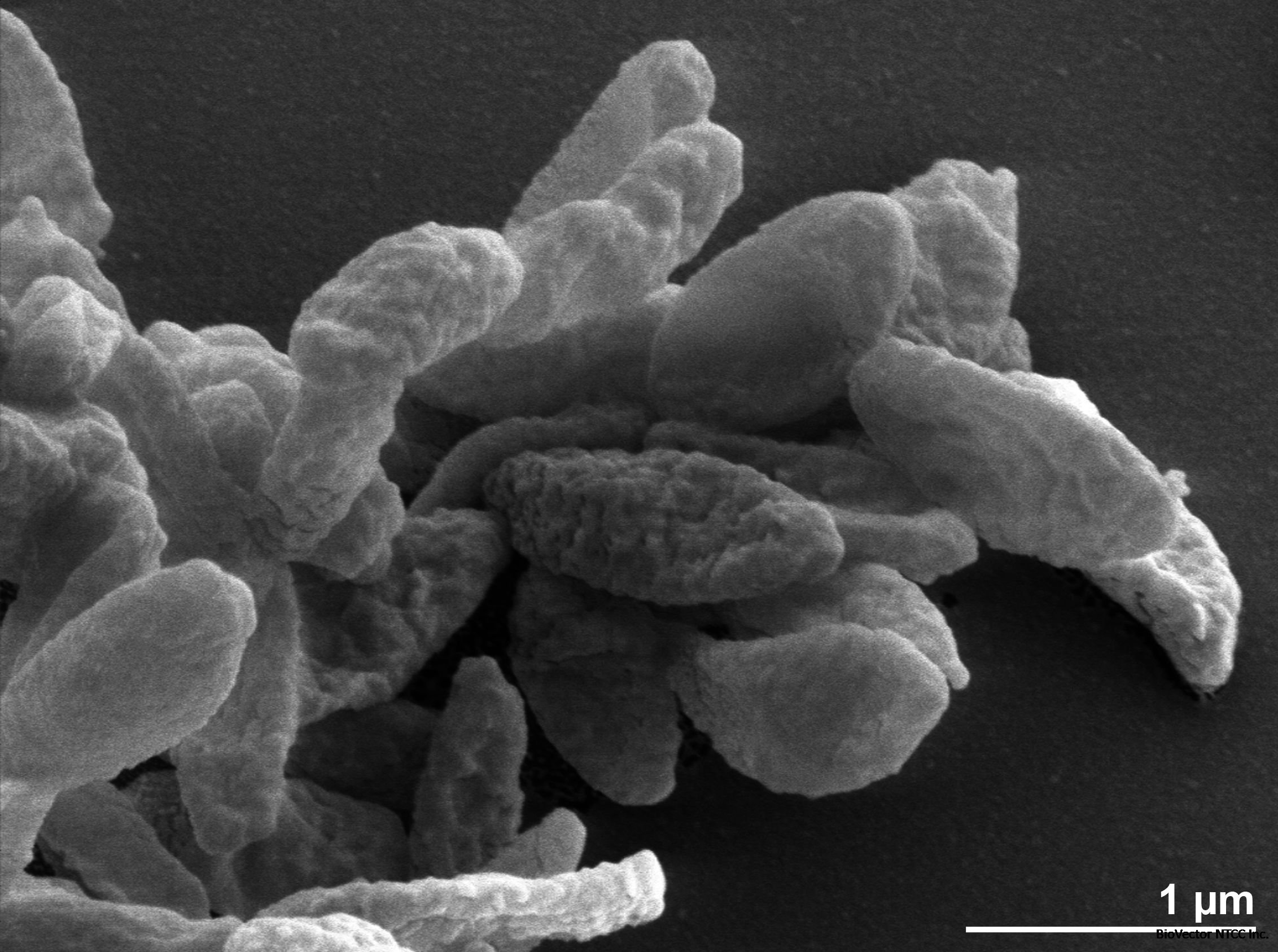 Odoribacter splanchnicus 1651/6 | Type strain | DSM 20712, ATCC 29572, CCUG 21054, CIP 104287, LMG 8202, NCTC 10825, CCUG 21054 A, CCM 6029, JCM 15291 | BacDiveID:12520