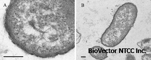 Ultrastructural Analysis of the Extracellular Matter Secreted by the  Psychrotolerant Bacterium Pseudoalteromonas antarctica NF3 | Microbial  Ecology