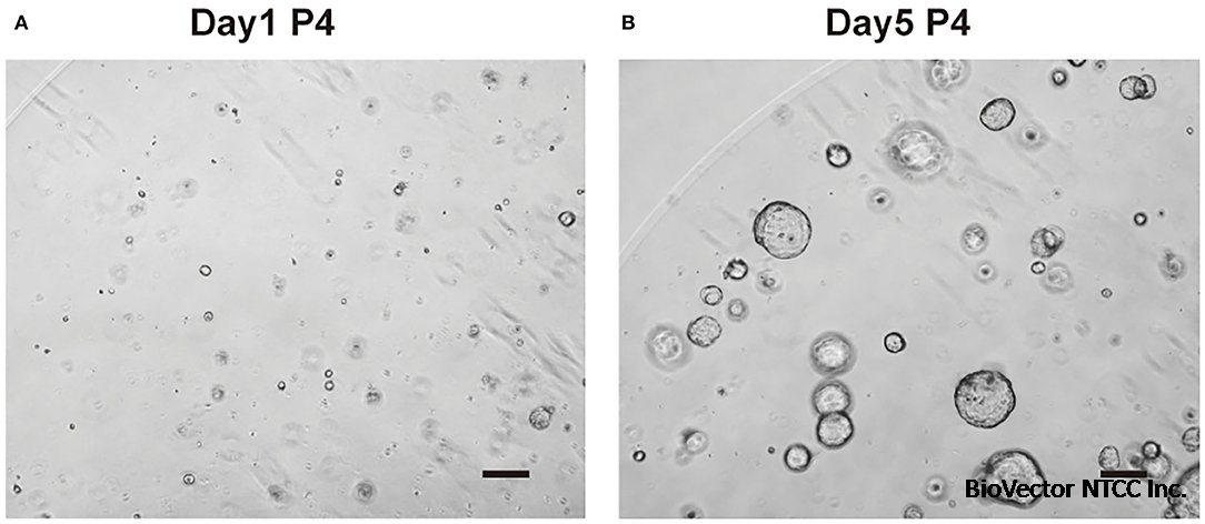 Frontiers | Highly Efficient Methods to Culture Mouse Cholangiocytes and  Small Intestine Organoids