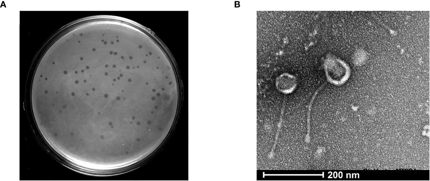 Frontiers | Isolation and characterization of a novel mycobacteriophage Kashi-VT1 infecting Mycobacterium species