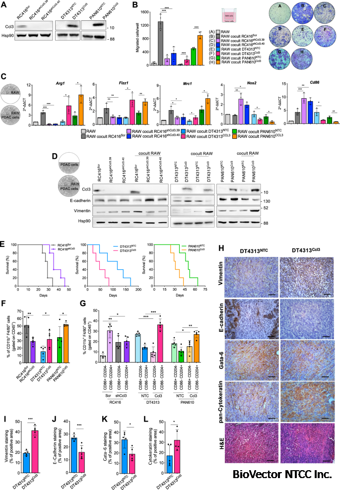 CCL3 predicts exceptional response to TGFβ inhibition in basal-like  pancreatic cancer enriched in LIF-producing macrophages | npj Precision  Oncology