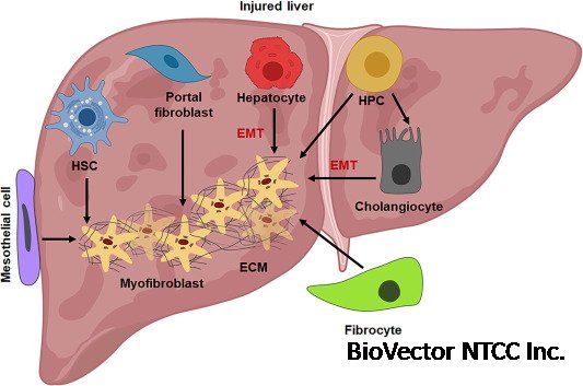Therapeutic potential of targeting regulatory mechanisms of hepatic  stellate cell activation in liver fibrosis - ScienceDirect