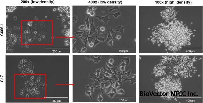 Characterization and comparison of two NPC cell lines, C17 and C666-1, as  models for studying the pathogenesis of nasopharyngeal carcinoma -  ScienceDirect