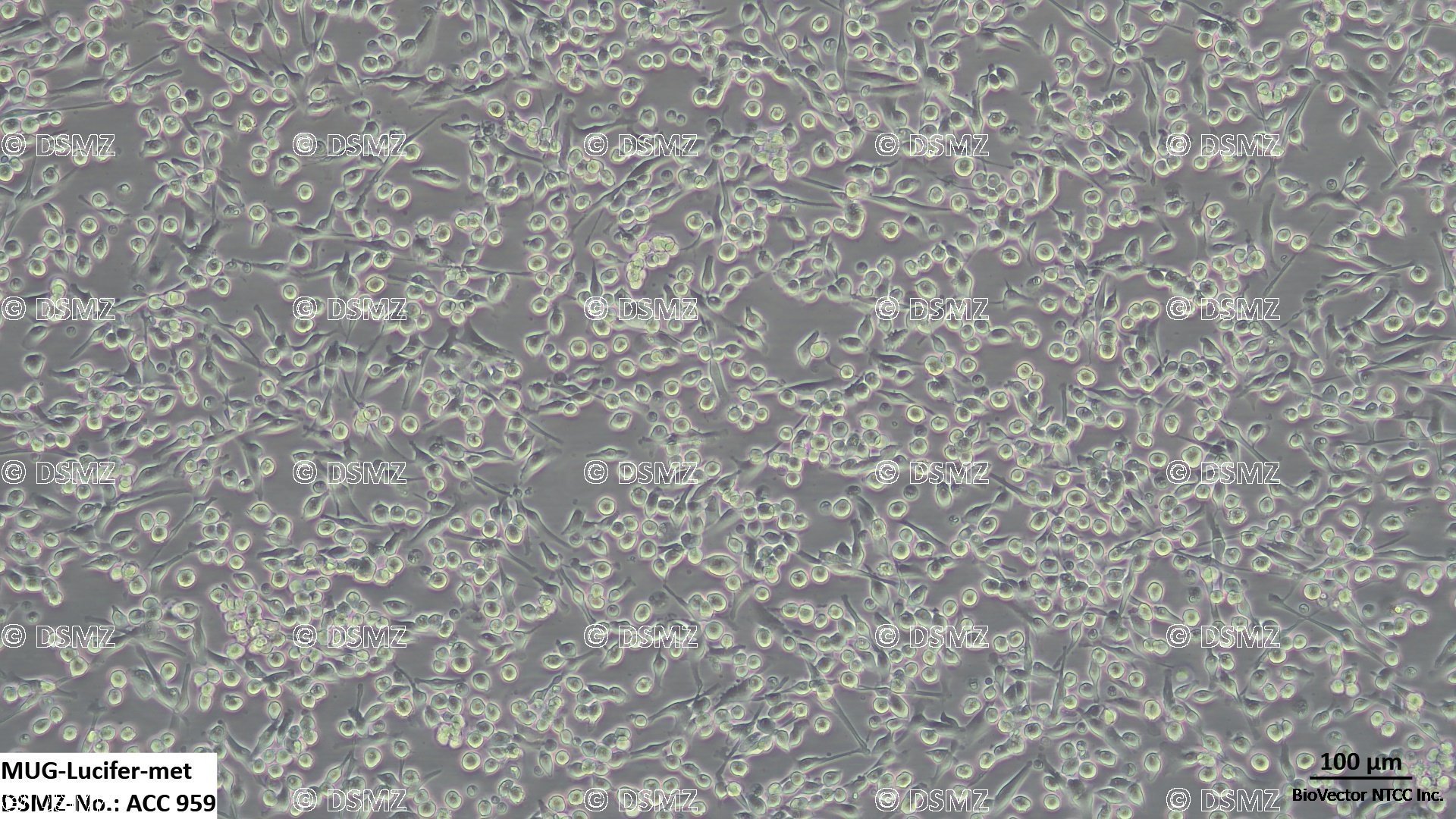 German Collection of Microorganisms and Cell Cultures GmbH:Welcome to the  Leibniz Institute DSMZ | MUG-Lucifer-met