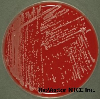Acinetobacter calcoaceticus