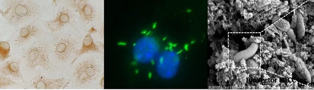 国产疫苗获批临床试验：为生猪健康筑起绿色防线—新闻—科学网