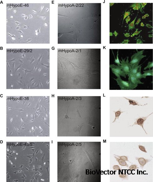 Hypothalamic cell lines to investigate neuroendocrine control mechanisms - ScienceDirect